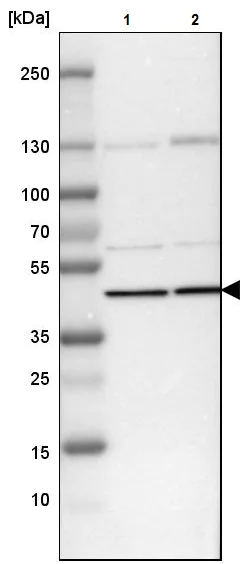 Western blot - Anti-Septin 2 antibody (AB224410)