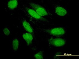 Immunocytochemistry/ Immunofluorescence - Anti-Septin 2 antibody (AB88657), expandable thumbnail