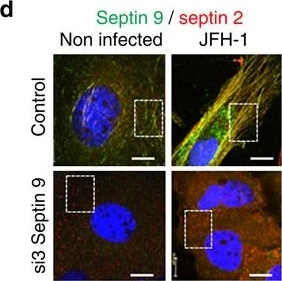Immunocytochemistry/ Immunofluorescence - Anti-Septin 2 antibody (AB88657)