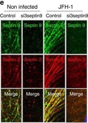 Immunocytochemistry/ Immunofluorescence - Anti-Septin 2 antibody (AB88657)
