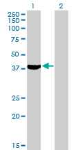 Western blot - Anti-Septin 2 antibody (AB88657), expandable thumbnail