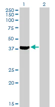 Western blot - Anti-Septin 2 antibody (AB88657)