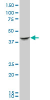 Western blot - Anti-Septin 2 antibody (AB88657), expandable thumbnail