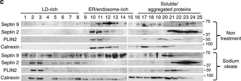 Western blot - Anti-Septin 2 antibody (AB88657)
