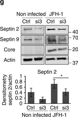 Western blot - Anti-Septin 2 antibody (AB88657)