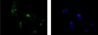Immunocytochemistry/ Immunofluorescence - Anti-Septin 2 antibody [EPR12122] (AB187654)