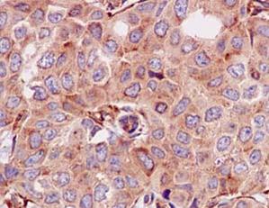 Immunohistochemistry (Formalin/PFA-fixed paraffin-embedded sections) - Anti-Septin 2 antibody [EPR12122] (AB187654)