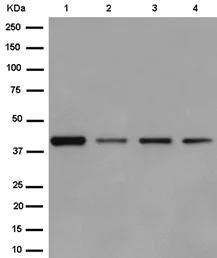 Western blot - Anti-Septin 2 antibody [EPR12122] (AB187654)