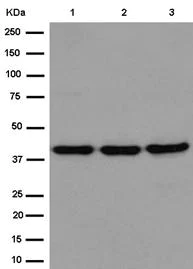 Western blot - Anti-Septin 2 antibody [EPR12122] (AB187654)
