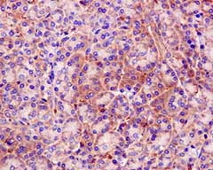 Immunohistochemistry (Formalin/PFA-fixed paraffin-embedded sections) - Anti-Septin 2 antibody [EPR12123] (AB179436)