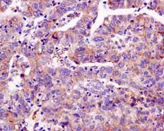 Immunohistochemistry (Formalin/PFA-fixed paraffin-embedded sections) - Anti-Septin 2 antibody [EPR12123] (AB179436)