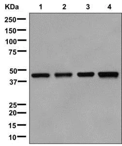 Western blot - Anti-Septin 2 antibody [EPR12123] (AB179436)