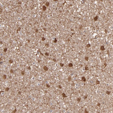 Immunohistochemistry (Formalin/PFA-fixed paraffin-embedded sections) - Anti-Septin 3 antibody (AB224332)