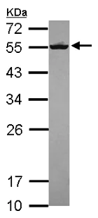 Western blot - Anti-Septin 8 antibody (AB154112)
