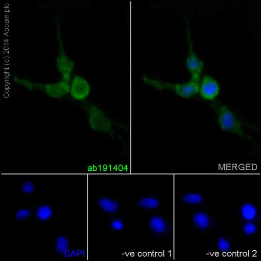 Immunocytochemistry/ Immunofluorescence - Anti-Septin 8 antibody [EPR16099] (AB191404)