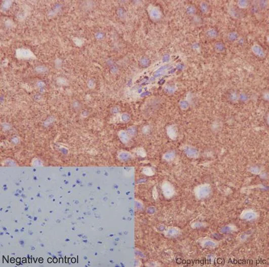 Immunohistochemistry (Formalin/PFA-fixed paraffin-embedded sections) - Anti-Septin 8 antibody [EPR16099] - BSA and Azide free (AB251065)