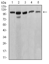 Western blot - Anti-SERCA1 ATPase antibody [3D1H6] (AB233647)