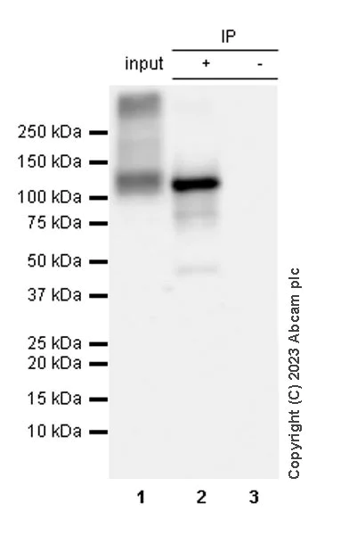 Immunoprecipitation - Anti-SERCA1 ATPase antibody [EPR28061-7] (AB314660)