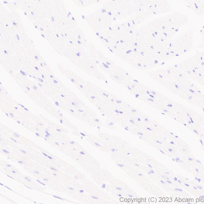Immunohistochemistry (Formalin/PFA-fixed paraffin-embedded sections) - Anti-SERCA1 ATPase antibody [EPR28061-7] - BSA and Azide free (ab314661), expandable thumbnail