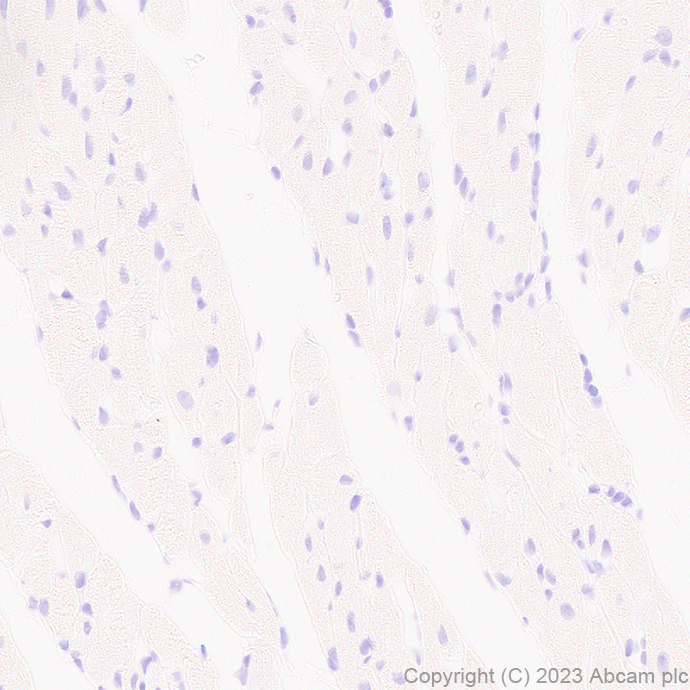 Immunohistochemistry (Formalin/PFA-fixed paraffin-embedded sections) - Anti-SERCA1 ATPase antibody [EPR28061-7] - BSA and Azide free (AB314661), expandable thumbnail