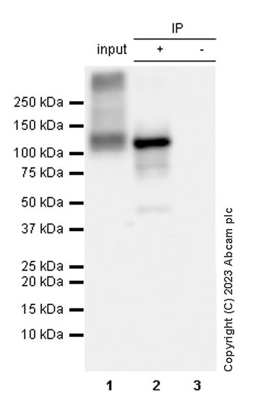 Immunoprecipitation - Anti-SERCA1 ATPase antibody [EPR28061-7] - BSA and Azide free (ab314661), expandable thumbnail