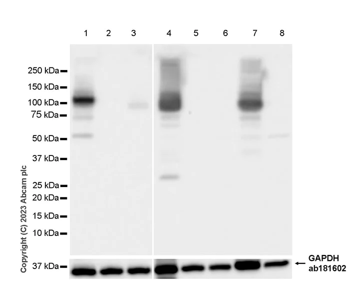Western blot - Anti-SERCA1 ATPase antibody [EPR28061-7] - BSA and Azide free (AB314661)