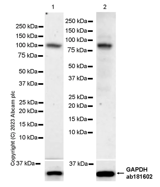 Western blot - Anti-SERCA1 ATPase antibody [EPR28061-7] - BSA and Azide free (AB314661)