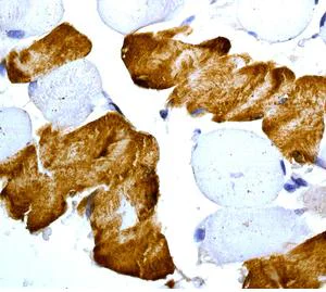 Immunohistochemistry (Formalin/PFA-fixed paraffin-embedded sections) - Anti-SERCA1 ATPase antibody [EPR7321] (AB133275)