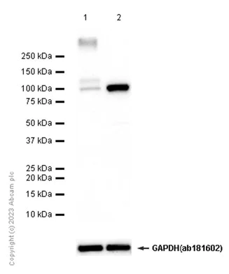 Western blot - Anti-SERCA1 ATPase antibody [EPR7321] (AB133275)