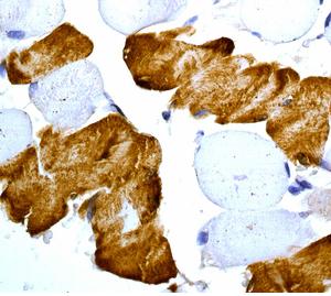 Immunohistochemistry (Formalin/PFA-fixed paraffin-embedded sections) - Anti-SERCA1 ATPase antibody [EPR7321] - BSA and Azide free (AB248440)