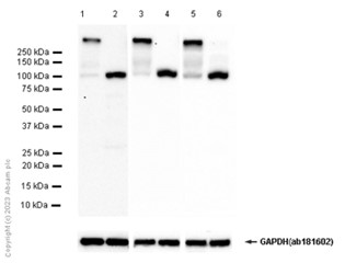 Western blot - Anti-SERCA1 ATPase antibody [EPR7322] (AB129104), expandable thumbnail