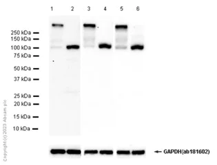 Western blot - Anti-SERCA1 ATPase antibody [EPR7322] - BSA and Azide free (AB248302)