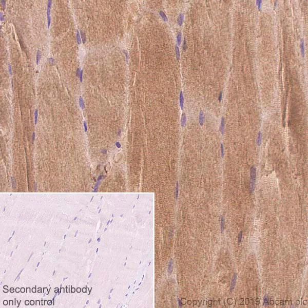 Immunohistochemistry (Formalin/PFA-fixed paraffin-embedded sections) - Anti-SERCA1 ATPase antibody [IIH11] (AB2818)