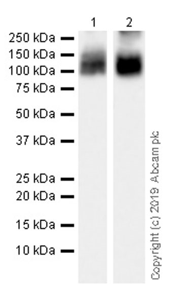 Anti-SERCA1 ATPase antibody [IIH11]