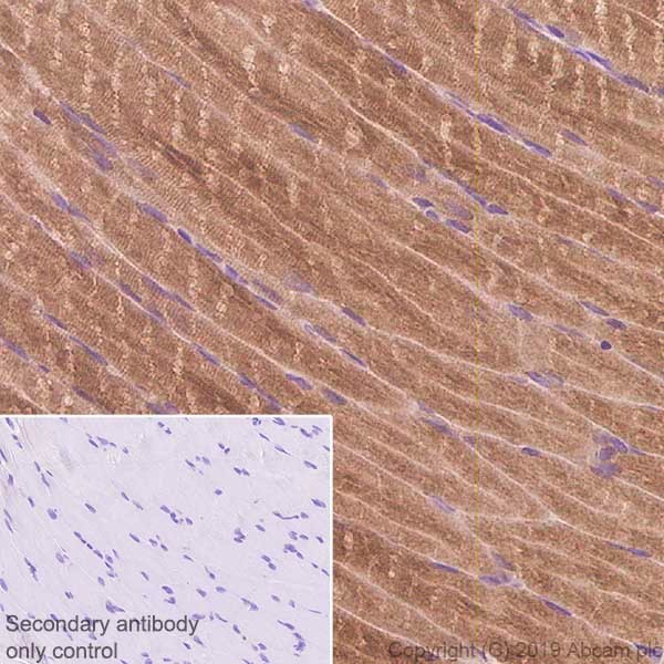 Immunohistochemistry (Formalin/PFA-fixed paraffin-embedded sections) - Anti-SERCA1 ATPase antibody [IIH11] - BSA and Azide free (AB255961)