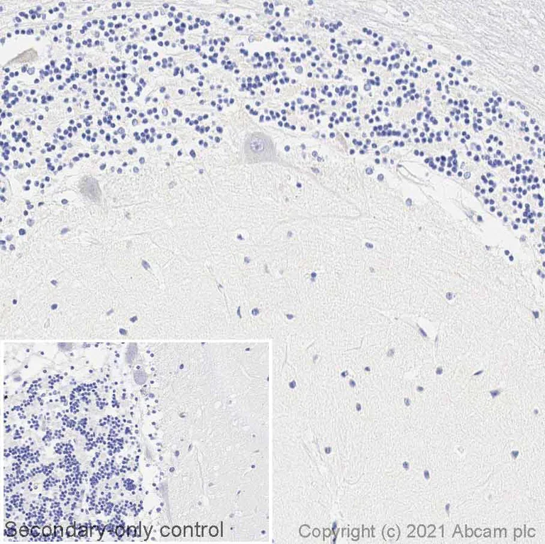 Immunohistochemistry (Formalin/PFA-fixed paraffin-embedded sections) - Anti-SERCA1 ATPase antibody [VE121G9] (AB2819)