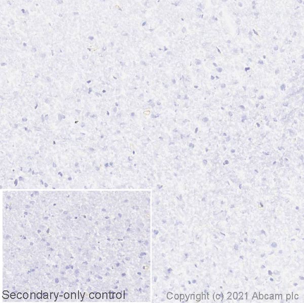 Immunohistochemistry (Frozen sections) - Anti-SERCA1 ATPase antibody [VE121G9] (ab2819), expandable thumbnail