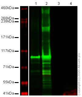 Western blot - Anti-SERCA1 ATPase antibody [VE121G9] (AB2819)