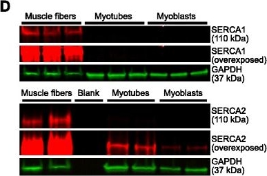 Western blot - Anti-SERCA1 ATPase antibody [VE121G9] (ab2819), expandable thumbnail