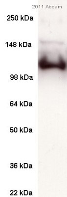 Western blot - Anti-SERCA1 ATPase antibody [VE121G9] (ab2819), expandable thumbnail