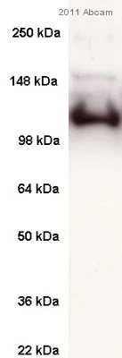 Western blot - Anti-SERCA1 ATPase antibody [VE121G9] (AB2819)