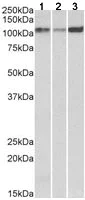 Western blot - Anti-SERCA2 ATPase antibody (AB183531)