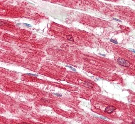 Immunohistochemistry (Formalin/PFA-fixed paraffin-embedded sections) - Anti-SERCA2 ATPase antibody (AB219173)