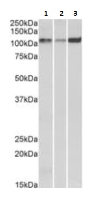 Western blot - Anti-SERCA2 ATPase antibody (AB219173), expandable thumbnail