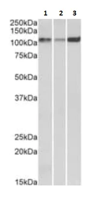 Western blot - Anti-SERCA2 ATPase antibody (AB219173)