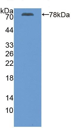 Western blot - Anti-SERCA2 ATPase antibody (AB233159), expandable thumbnail