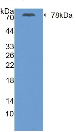 Western blot - Anti-SERCA2 ATPase antibody (AB233159)
