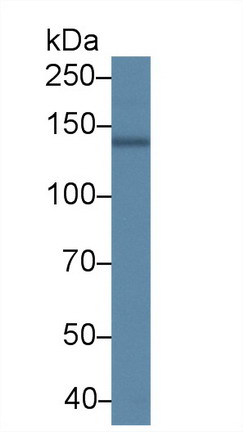 Western blot - Anti-SERCA2 ATPase antibody (AB233159), expandable thumbnail