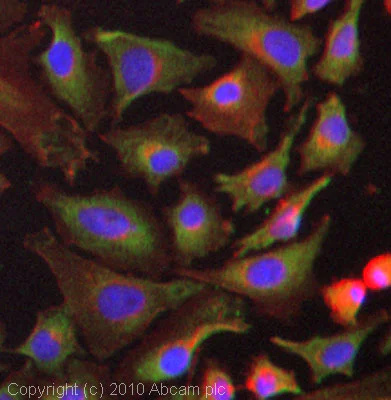 Immunocytochemistry/ Immunofluorescence - Anti-SERCA2 ATPase antibody (AB3625)