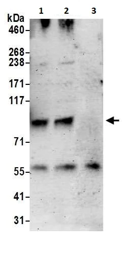 Immunoprecipitation - Anti-SERCA2 ATPase antibody (AB3625)